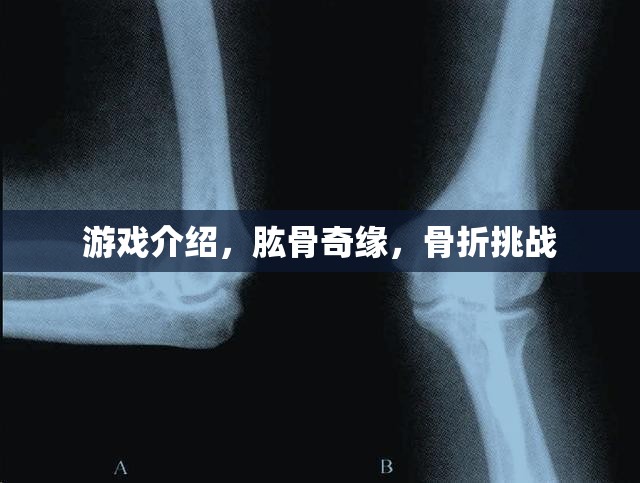 肱骨奇緣，骨折挑戰(zhàn)游戲介紹